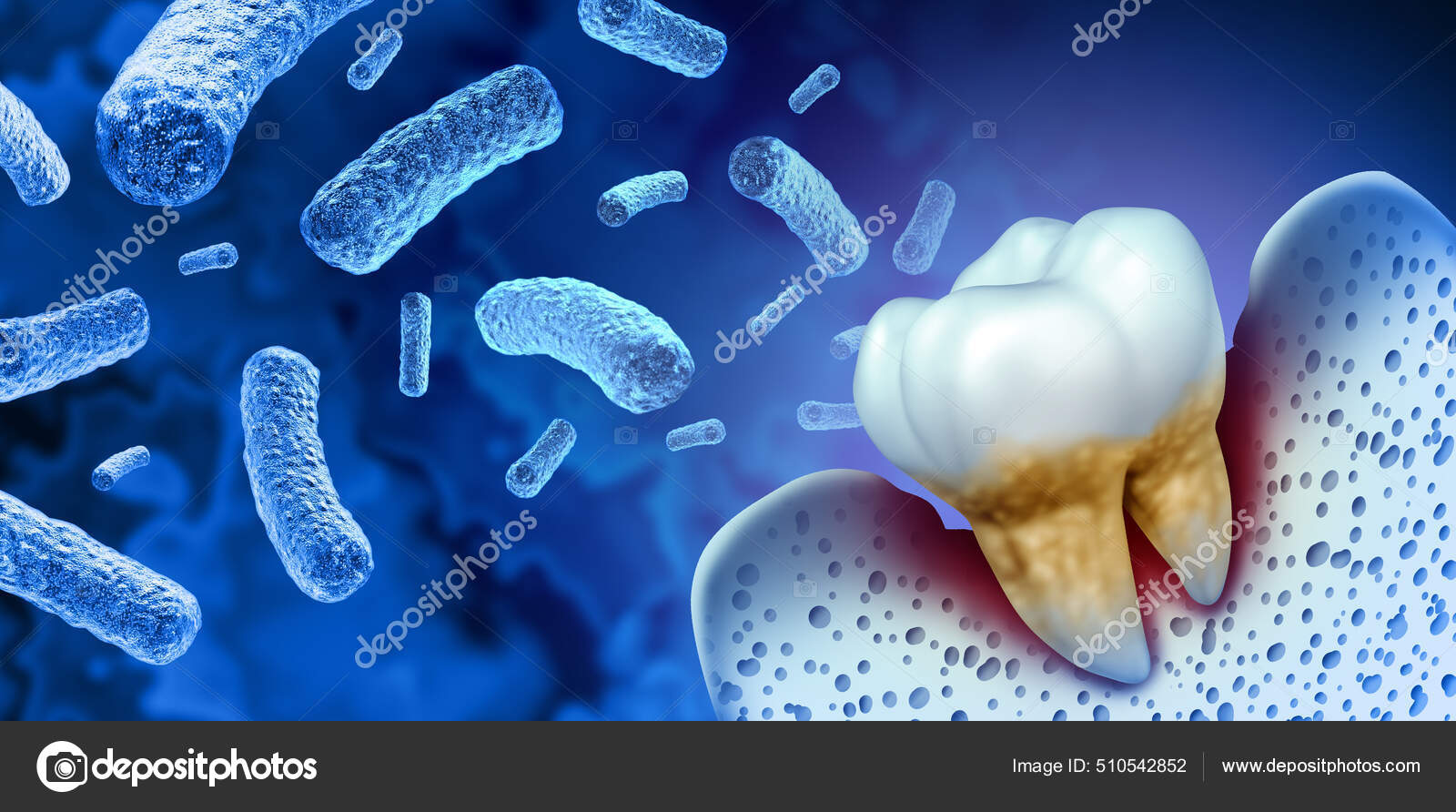 микроорганизмы вызывающие кариес зубов. кариесогенные бактерии. микробы-возбудители кариеса зубов. болезни человека вызываемые бактериями. микроорганизмы вызывающие кариес.