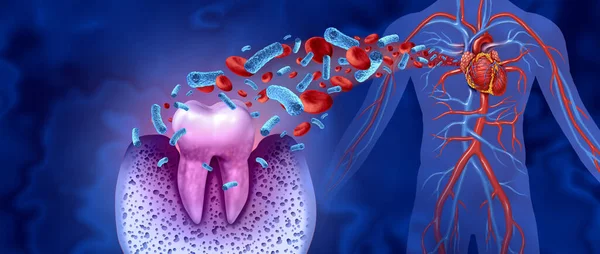 Caries Dental Enfermedades Del Corazón Como Molar Poco Saludable Con — Foto de Stock