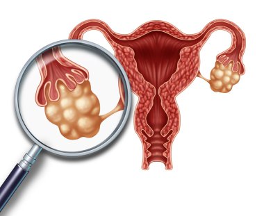 Ovaries concept clipart