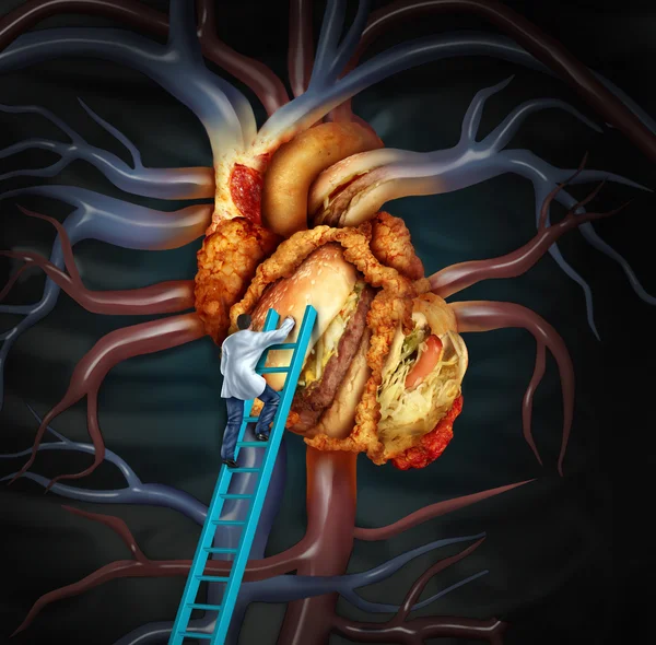 Wysoki poziom cholesterolu leczenie — Zdjęcie stockowe