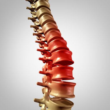 Spine Pain clipart