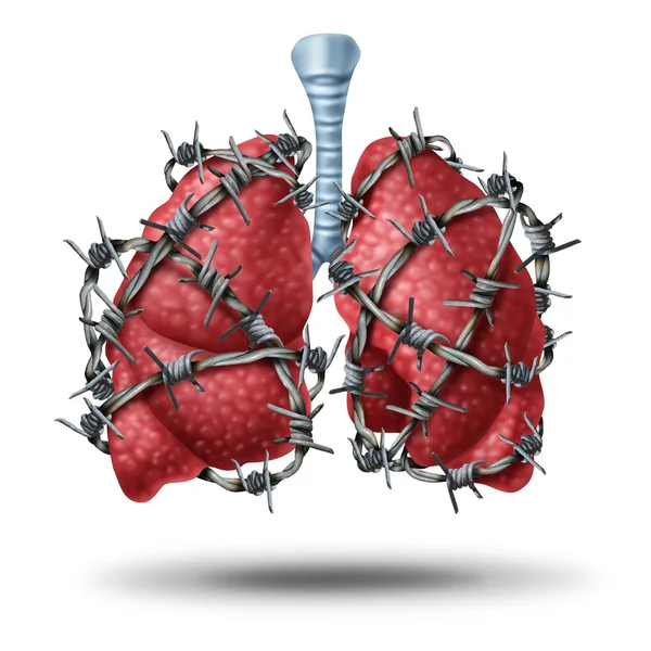 Malattia del dolore polmonare — Foto Stock