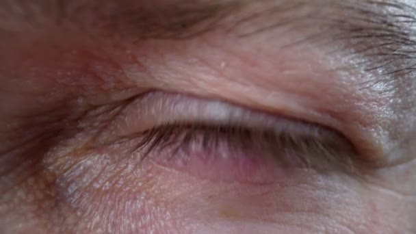 Olhos de close-up extremos com brancos vermelhos, depois de insônia, trabalho longo no computador. — Vídeo de Stock