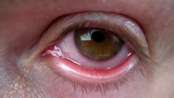 Extreme close-up ogen met rood wit, na slapeloosheid, lang werken op de computer. — Stockvideo