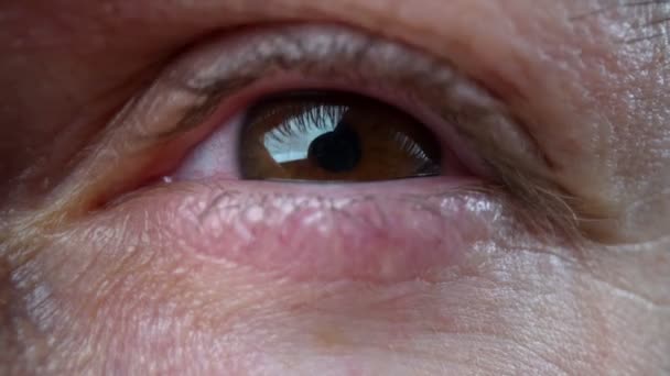 Olhos de close-up extremos com brancos vermelhos, depois de insônia, trabalho longo no computador. — Vídeo de Stock