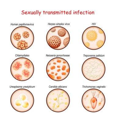 Sexually transmitted infection. Close-up of causative agents of Venereal disease: Ureaplasma, Trichomonas, Candida, Treponema, Chlamydiales, Neisseria gonorrhoeae, Herpes virus, HIV, papillomavirus clipart