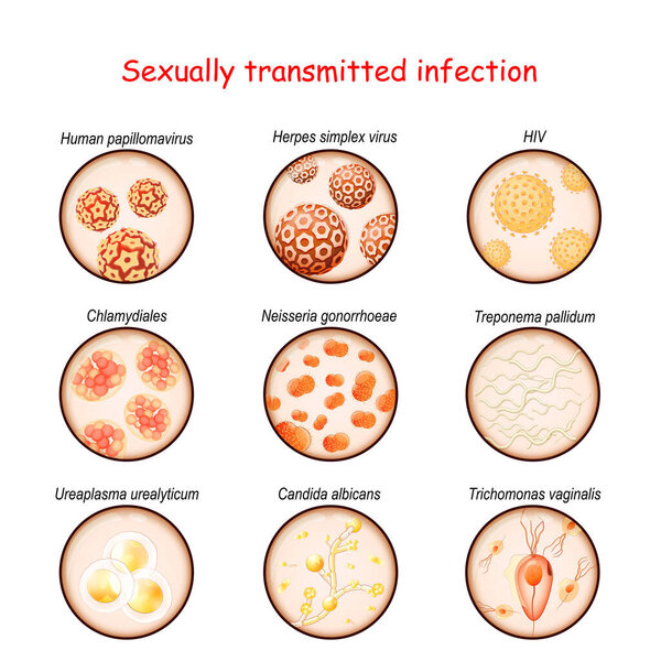 Sexually transmitted infection. Close-up of causative agents of Venereal disease: Ureaplasma, Trichomonas, Candida, Treponema, Chlamydiales, Neisseria gonorrhoeae, Herpes virus, HIV, papillomavirus