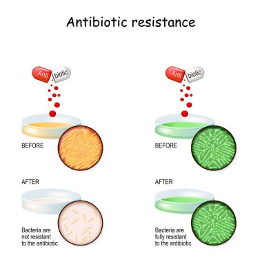 Antibiyotik direnci. İki Petri kabı ve bakteri deneyi. Antibiyotik tedavisinden önce ve sonra bakteri kolonilerini karşılaştırın. bulaşıcı hastalıklar