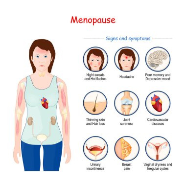 Menopoz. Orgazm belirtileri ve semptomlar. Kadınlarla vektör ilüstrasyonu, menopoz belirtileri ve fiziksel değişiklikler. Kadın Sağlığı hakkında afiş.