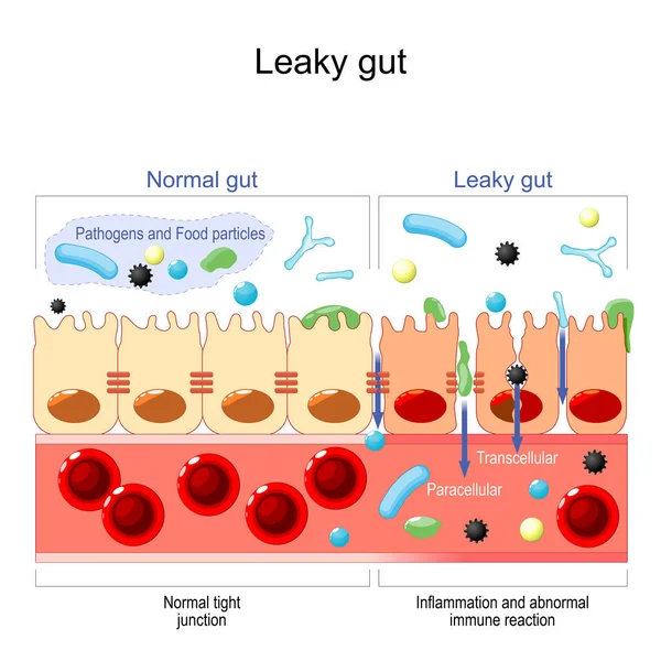 Leaky Gut Cells Gut Lining Held Tightly Together Intestine Celiac — Archivo Imágenes Vectoriales