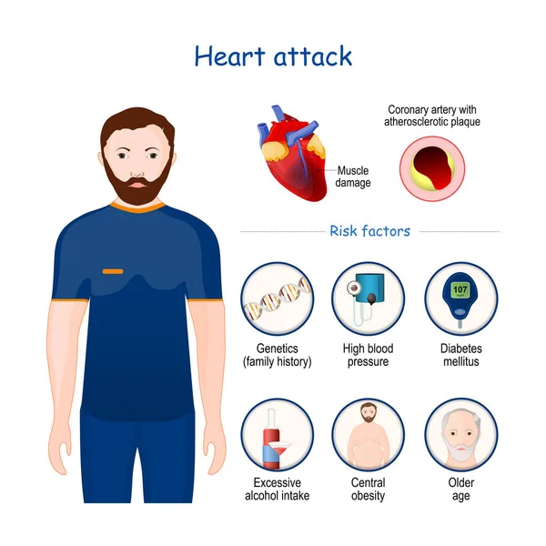 Infarto Segni Sintomi Fattori Rischio Infografica Sezione Dell Arteria Coronarica — Vettoriale Stock