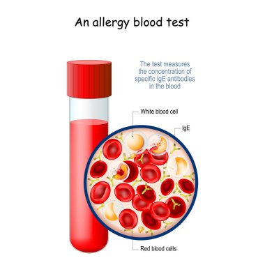 allergy blood test. The test measures the concentration of specific IgE antibodies in the blood. Close-up of realistic test tube with IgE and Red blood cells. Vector illustration clipart