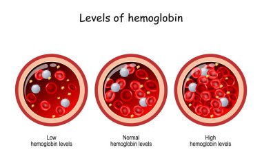 Hemoglobin seviyesi. Kan damarının kırmızı kan hücreleriyle çapraz kesiti. Vektör çizimi. karşılaştırma ve düşük ve yüksek hemoglobin seviyeleri arasındaki fark