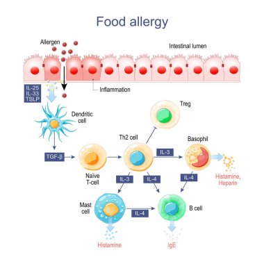 Gıda alerjisi. Bağırsak iltihabı. Alerjenler, Histamin ve bağışıklık hücreleri, bunlar alerjik reaksiyon oluşturur..