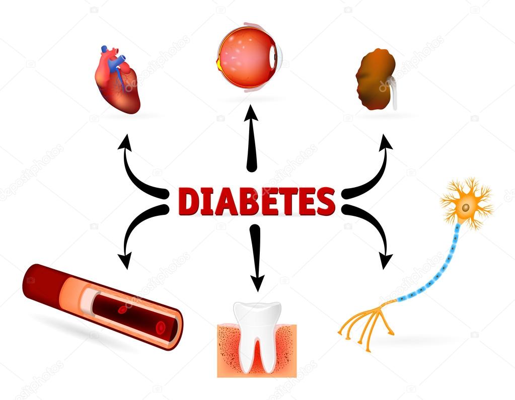 Complications of diabetes mellitus Stock Vector Image by ©edesignua  #56955029