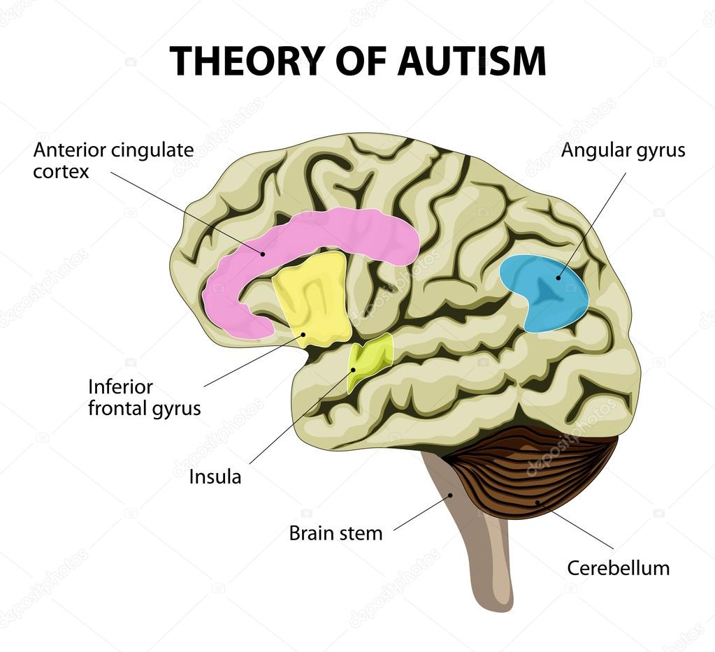 Theory of autism