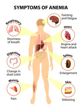 symptoms of anemia clipart