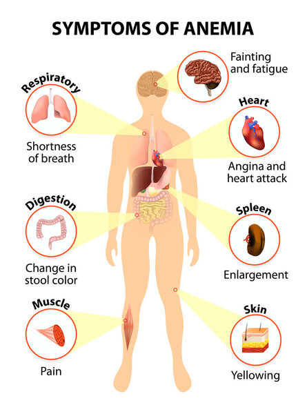 symptoms of anemia