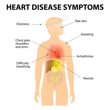Heart Disease Symptoms clipart