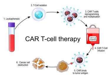 Araba T-hücre terapisi. Kanser immünoterapisi. Tümörü öldürmek için CAR-T hücresi. Kişisel tıp. Vektör illüstrasyonu