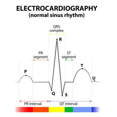 EKG normal sinüs ritmi içinde bir kalp