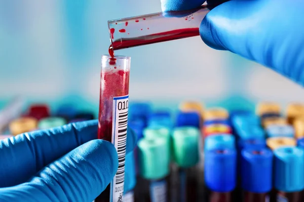 Lab Technician Who Mixes Blood Sample Different Tubes Can Contaminate — Stock Photo, Image