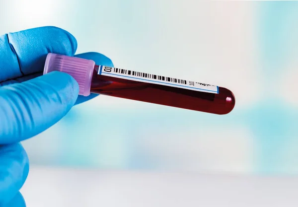血液バンクに血液サンプルチューブを保持手 血液学研究室での凝固検査用血液サンプル — ストック写真