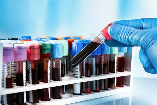 Hematoloji laboratuarında analiz için hastalardan alınan kan testleriyle dolu raflar. Analitik laboratuarda test için tepsi kan tüpleriyle çalışan bir teknisyen.
