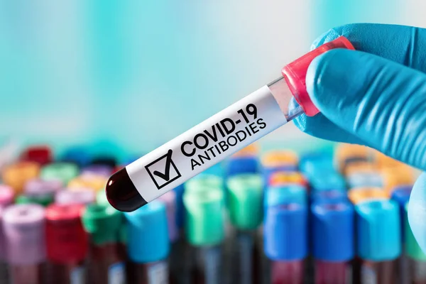 Arzt Mit Blutgefäß Mit Antikörpern Gegen Infektionskrankheit Coronavirus Covid Virus — Stockfoto