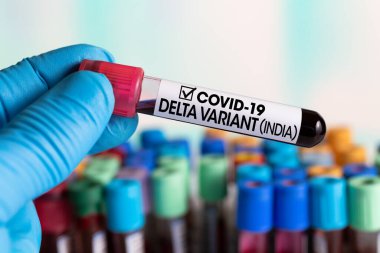 Laboratuvardaki laboratuvar teknisyeni elinde Covid-19 DELTA Varyant Hindistan / Doktor etiketi ile tanımlanmış bir tüp kan testi tutuyor.