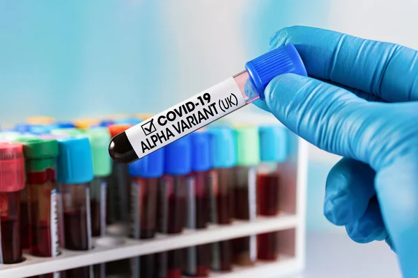 血液検査管を保持する技術者は Covid Alpha Variant Ukというラベルで識別された Alphaと呼ばれるコロナウイルス株の英国で検出された新しい変異体のための正の血液サンプルを持つ医師 — ストック写真