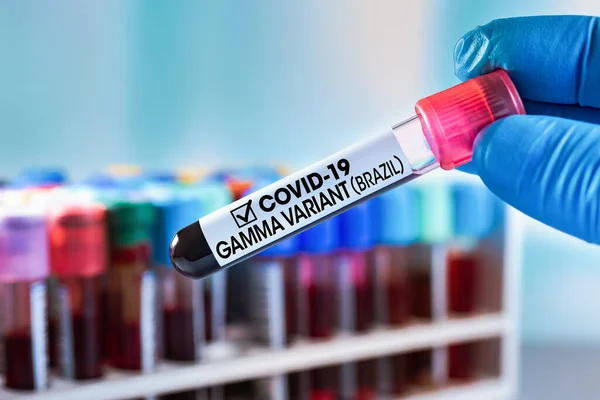 Технік Який Проводить Аналіз Крові Ототожнюється Етикеткою Covid Gamma Варіант — стокове фото