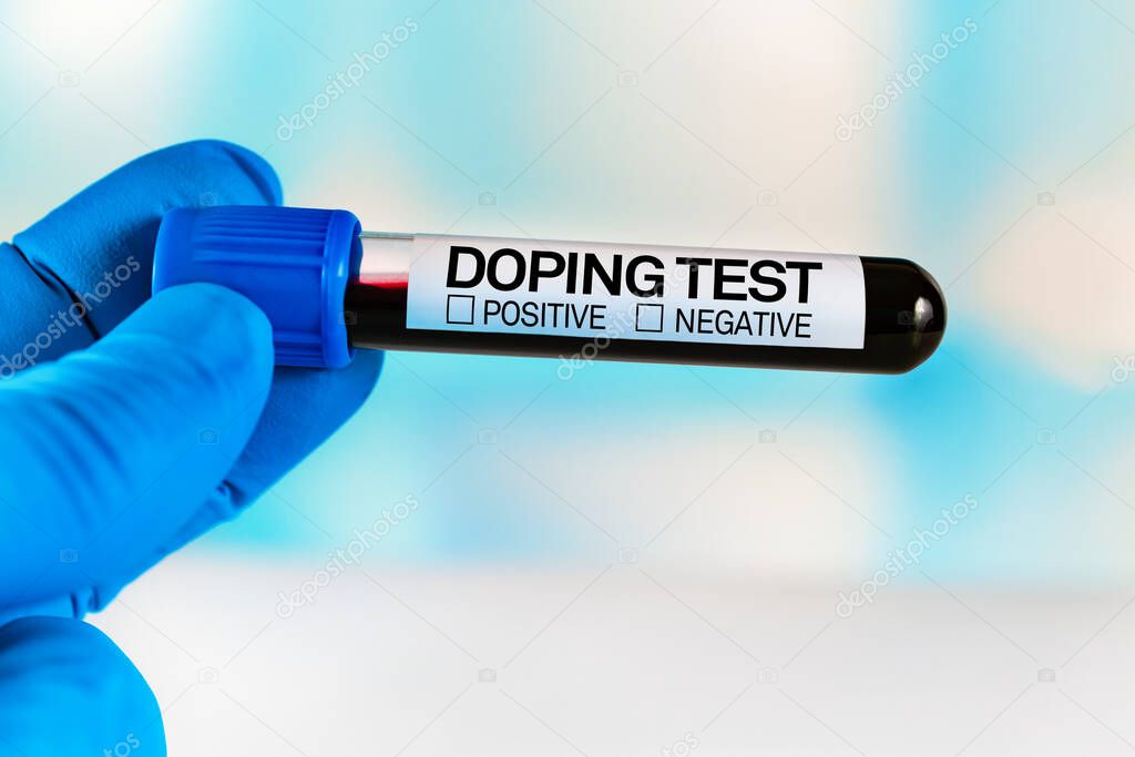 Tube of blood for analysis labeled Doping Test. Lab technician holding a blood sample tube for analysis doping substances in the laboratory