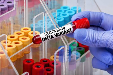 Doctor testing with blood test tube from patient infected with Coronavirus covid-19 virus Delta variant. Doctor epidemiologist holding blood tube for test detection of virus Covid-19 Delta Variant with positive result  clipart