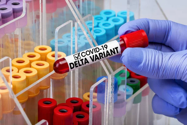 Coronavirus covid-19 virüsü taşıyan hastadan alınan kan test tüpüyle doktor testi. Doktor epidemiyoloji uzmanı, Covid-19 Delta Varyantı virüsünün tespiti için kan tüpü tutuyor. 