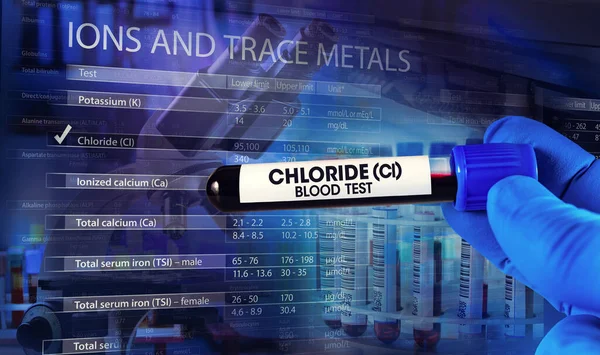 lab technician with blood tube and hematology analyzer laboratory equipment and screen with data report and Reference values. Blood Tube of patient for analysis and research named Chloride Blood test