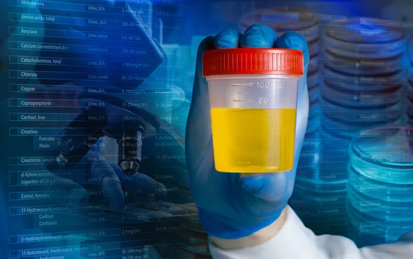 Medico Che Effettua Test Del Contenitore Delle Urine Laboratorio Analisi — Foto Stock