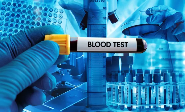 Background Laboratory Images Technology Testing Blood Tests Doctor Tube Blood — Stock Photo, Image