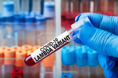 Coronavirus covid-19 virüsü taşıyan Lambda virüsünün kan test tüpüyle doktor testi. Doktor epidemiyoloji uzmanı, Covid-19 Lambda Varyantı virüsünün tespiti için kan örneği tüpü tutuyor.  