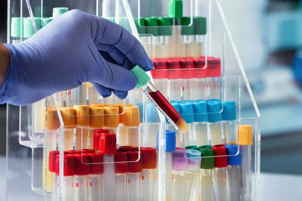 Técnico Sosteniendo Tubo Muestra Sangre Para Análisis Laboratorio Médico Con —  Fotos de Stock