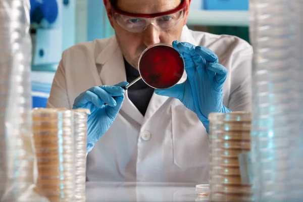 technician scientist analyzing petri plate inoculated in biochemistry laboratory. Biologist scientist researcher analyzing petri dish culture in the lab