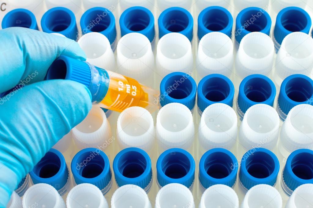 investigator's hand holding pcr tube at rack in laboratory