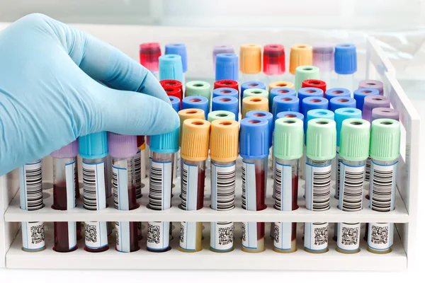 Hand doctor holding a blood tube test with bar code for analysis — Stock Photo, Image