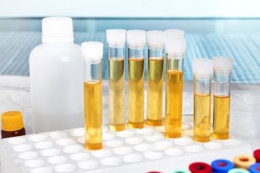 Analysis of urine in lab clipart