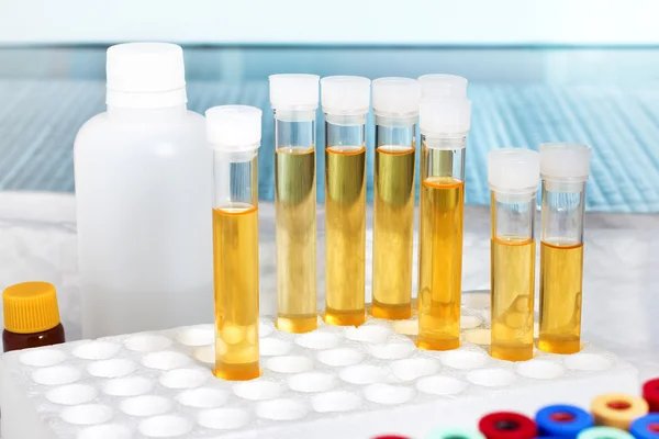 Analysis of urine in lab — Stock Photo, Image