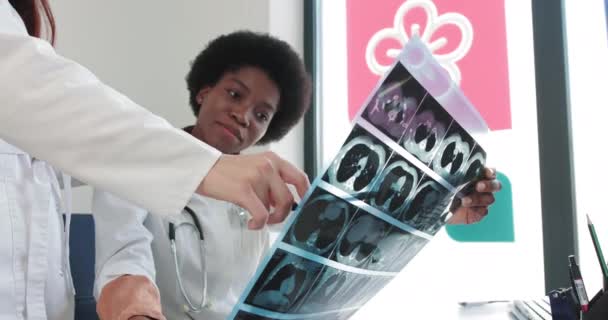 Медицинские работники обсуждают рентгеновскую фотографию. Две женщины-специалисты в медицинской форме осматривают рентгеновские снимки на фоне нового оборудования в клинике. — стоковое видео