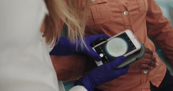 Dermatologe untersucht eine Haut. Der Dermatologe erforscht ein Geburtszeichen am Telefon, das mit einem speziellen Dermoskopie-Tool verbunden ist, vor der Laserentfernung eines Geburtszeichens. — Stockvideo