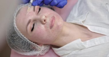 Botoks Enjeksiyonu, Mezoterapi, Botulinum Terapisi, Biorevitalizasyon veya yüz derisini plazma kaldırma. Güzellik uzmanının kozmetik kliniğinde genç ve güzel bir kadına iğne yaptığı yakın çekim..