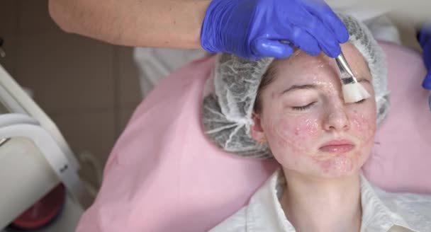 Hidratación y tratamiento del acné de la piel. Joven cosmetóloga femenina en guantes médicos aplica máscara de gel a la cara de la joven adolescente con un cepillo. Cuidado de la piel, Tratamiento facial, Concepto de cosmetología. — Vídeos de Stock