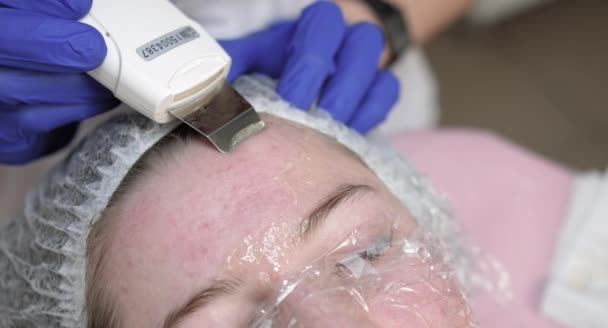 Problemhud behandling på skönhetssalong. Närbild av kvinnlig läkare kosmetolog i medicinsk mask och gummihandskar, med hjälp av ultraljudsskrubber medan rengöring kvinnlig klient ansikte. — Stockvideo